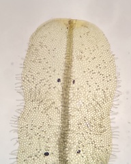 Metzgeria crassipilis