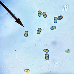 Amandinea dakotensis