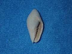 Pterygia