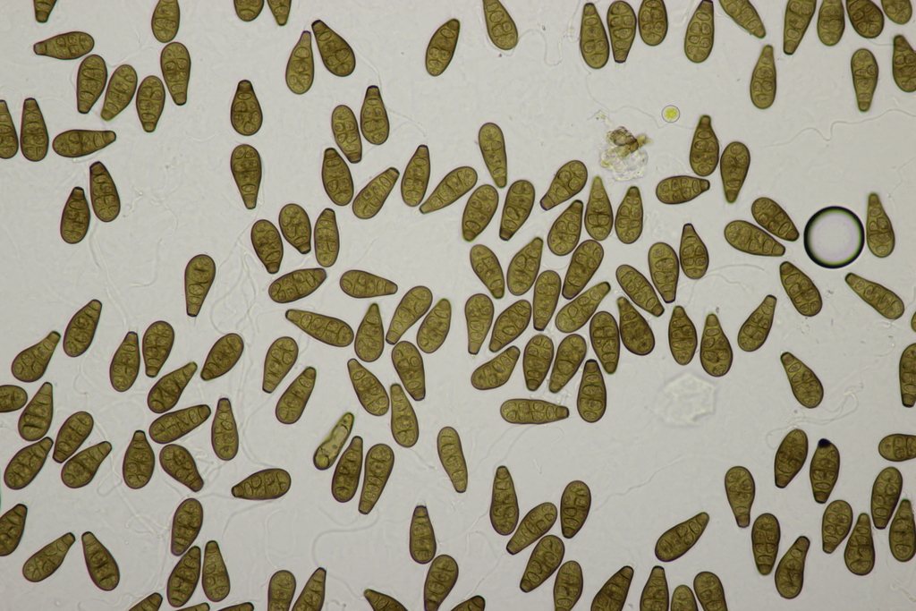 Prosthecium