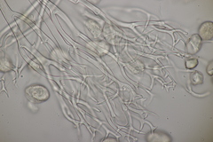 Peronospora alsinearum