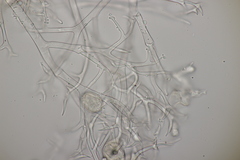 Peronospora alsinearum