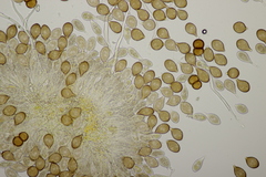 Cumminsiella mirabilissima