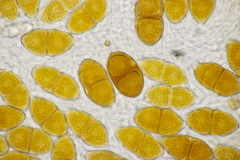 Gymnosporangium sabinae