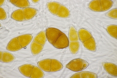 Gymnosporangium sabinae