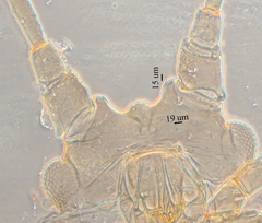 Hyperomyzus lactucae