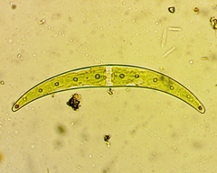 Closterium dianae