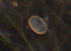 Cocconeis