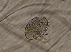 Cocconeis