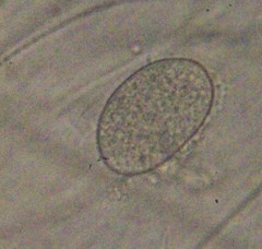 Cocconeis