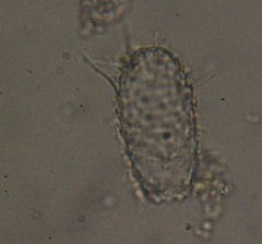 Euglypha acanthophora