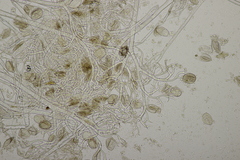Puccinia lapsanae