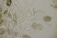 Puccinia lapsanae