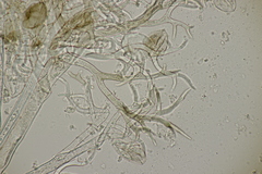 Puccinia lapsanae