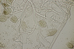 Puccinia lapsanae