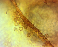 Tubifera applanata