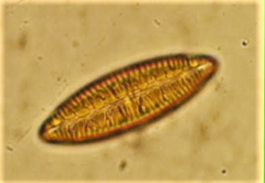 Surirella