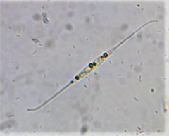 Nitzschia lorenziana