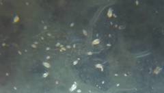 Tyrophagus putrescentiae