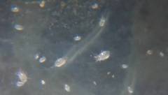 Tyrophagus putrescentiae