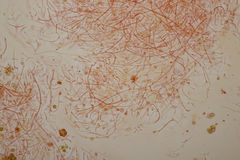 Tremella globispora