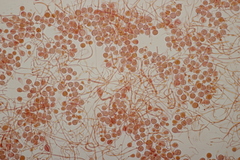 Tremella globispora