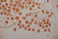 Tremella globispora
