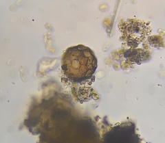 Arcella gibbosa