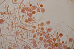 Tremella globispora