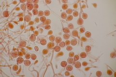Tremella globispora