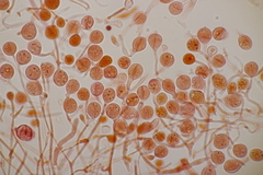 Tremella globispora