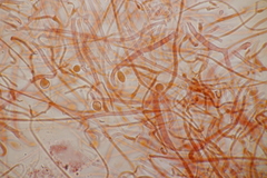 Tremella globispora