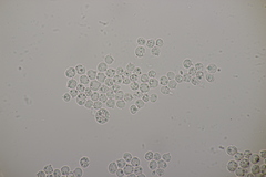 Tremella globispora