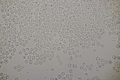 Tremella globispora
