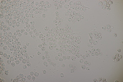 Tremella globispora