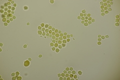 Tremella globispora