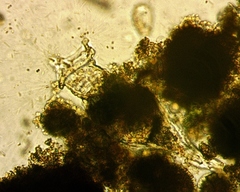 Collotheca