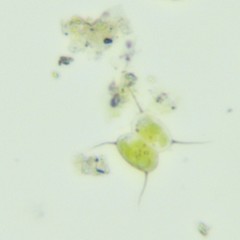 Scenedesmaceae