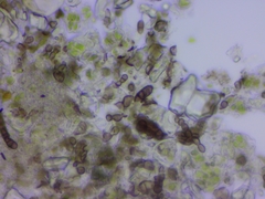 Eopyrenula intermedia