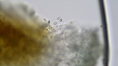 Mycoblastus sanguinarioides