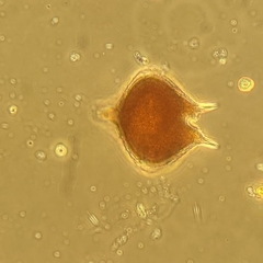 Protoperidinium