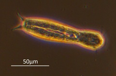 Gastrotricha