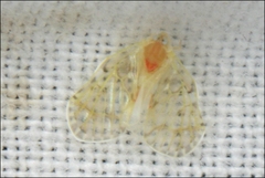 Saccharodite chrysonoe