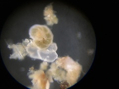 Cibicidoides variabilis