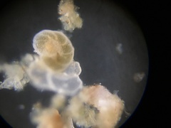 Cibicidoides variabilis