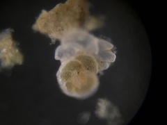 Cibicidoides variabilis