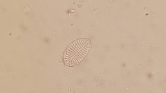 Cocconeis