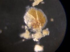 Discorbinella
