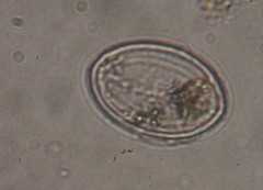 Cocconeis