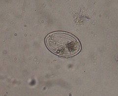 Cocconeis